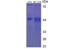 Image no. 2 for Melatonin (MT) protein (Ovalbumin) (ABIN1880130)