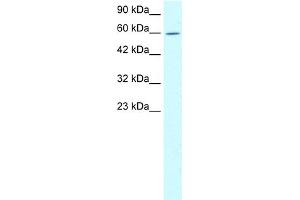 WB Suggested Anti-TRIM15 Antibody Titration:  1. (TRIM15 anticorps  (N-Term))