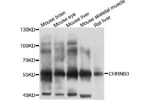Western blot analysis of extracts of various cell lines, using CHRNB3 antibody (ABIN4903288) at 1:1000 dilution. (CHRNB3 anticorps)