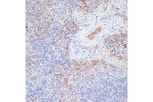Immunohistochemistry of paraffin-embedded mouse spleen using Cathepsin G antibody (ABIN6127686, ABIN6139228, ABIN6139230 and ABIN6217069) at dilution of 1:100 (40x lens).