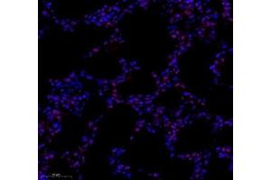 Immunofluorescence of paraffin embedded rat lung using tfiib (ABIN7074034) at dilution of 1: 500 (300x lens) (GTF2B anticorps)