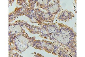 IHC analysis of SLC5A2 using anti-SLC5A2 antibody (ABIN6719506).
