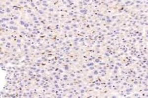 Immunohistochemistry of paraffin embedded mouse liver using F480 (ABIN7073801) at dilution of 1:1200 (200x lens) (F4/80 anticorps)