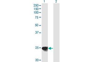 Western Blot analysis of YKT6 expression in transfected 293T cell line by YKT6 monoclonal antibody (M03), clone 1F8.
