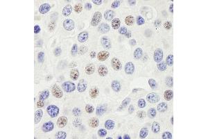 Immunohistochemistry (IHC) image for anti-PHD Finger Protein 6 (PHF6) (AA 1-50) antibody (ABIN7453757)