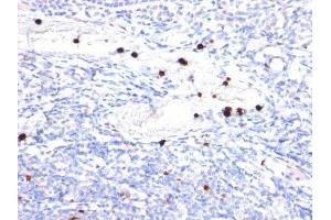 Image no. 1 for anti-Colony Stimulating Factor 3 (Granulocyte) (CSF3) antibody (ABIN6161622) (G-CSF anticorps)