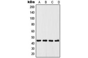 Western blot analysis of UGCG expression in A375 (A), MCF7 (B), Raw264. (UGCG anticorps  (N-Term))