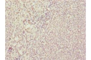 Immunohistochemistry of paraffin-embedded human tonsil tissue using ABIN7172439 at dilution of 1:100 (SUPT4H anticorps  (AA 1-117))