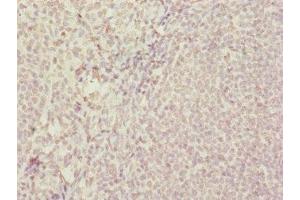 Immunohistochemistry of paraffin-embedded human tonsil tissue using ABIN7172439 at dilution of 1:100