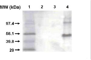 Western blot using CYP1A2 antibody . (CYP1A2 anticorps)