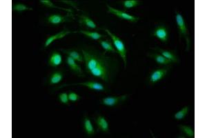 Immunofluorescence staining of Hela cells with ABIN7142198 at 1:200, counter-stained with DAPI. (PSMD1 anticorps  (Regulatory Subunit 10))