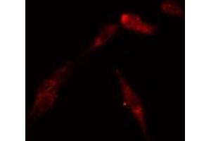 ABIN6269198 staining Hela by IF/ICC. (CDK2 anticorps  (Internal Region))