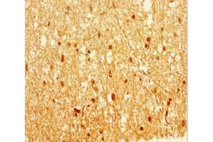 Immunohistochemistry of paraffin-embedded human brain tissue using ABIN7157846 at dilution of 1:100