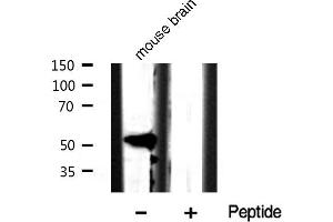 Western blot analysis of Keratin 8 phosphorylation expression in Mouse brain tissue lysates,The lane on the left is treated with the antigen-specific peptide.