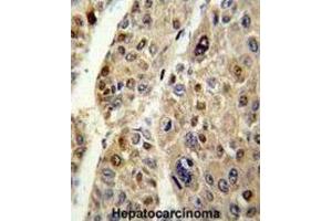 Immunohistochemistry (IHC) image for anti-Serpin Family C Member 1 (SERPINC1) antibody (ABIN3002768)