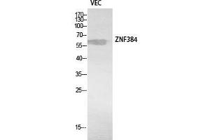 Western Blot (WB) analysis of VEC cells using ZNF384 Polyclonal Antibody. (ZNF384 anticorps  (Internal Region))
