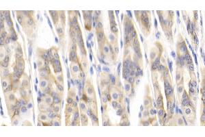 Detection of MCP1 in Mouse Stomach Tissue using Polyclonal Antibody to Monocyte Chemotactic Protein 1 (MCP1)