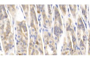 Detection of MCP1 in Mouse Stomach Tissue using Polyclonal Antibody to Monocyte Chemotactic Protein 1 (MCP1) (CCL2 anticorps  (AA 24-96))