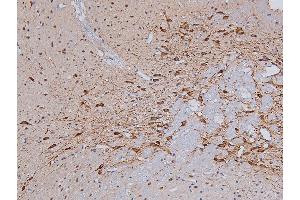 ABIN6267325 at 1/200 staining Rat brain tissue sections by IHC-P. (Tyrosine Hydroxylase anticorps  (pSer31))