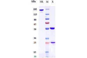 Anti-DLK1 Reference Antibody (LIV-1205) on SDS-PAGE under reducing (R) condition. (Recombinant DLK1 anticorps)