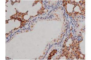 ABIN6267331 at 1/200 staining Mouse brain tissue sections by IHC-P.