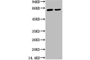 Western blot analysis of 1) Hela, 2) HepG2, diluted at 1:2000. (KRT6A anticorps)