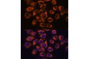 Immunofluorescence analysis of HeLa cells using SM antibody (ABIN7270612) at dilution of 1:100.