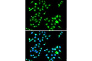 Immunofluorescence analysis of A549 cells using TWIST1 antibody (ABIN4905524). (TWIST1 anticorps)
