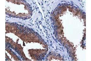 Immunohistochemical staining of paraffin-embedded Human prostate tissue using anti-ADI1 mouse monoclonal antibody. (ADI1 anticorps)