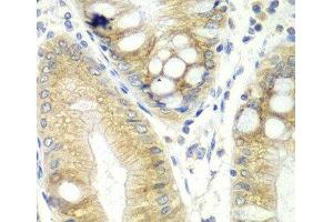 Immunohistochemistry of paraffin-embedded Human colon using CES2 Polyclonal Antibody at dilution of 1:100 (40x lens). (CES2 anticorps)