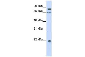 Western Blotting (WB) image for anti-SUMO1/sentrin Specific Peptidase 1 (SENP1) antibody (ABIN2459849) (SENP1 anticorps)