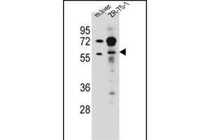 TRIM62 Antibody (C-term) (ABIN657216 and ABIN2837911) western blot analysis in mouse liver tissue and ZR-75-1 cell line lysates (35 μg/lane). (TRIM62 anticorps  (C-Term))