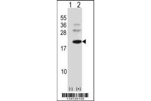Western blot analysis of BARX1 using rabbit polyclonal BARX1 Antibody using 293 cell lysates (2 ug/lane) either nontransfected (Lane 1) or transiently transfected (Lane 2) with the BARX1 gene. (BARX1 anticorps  (C-Term))
