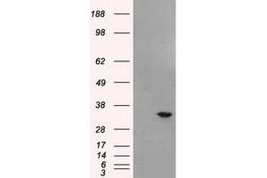 Western Blotting (WB) image for anti-Baculoviral IAP Repeat-Containing 7 (BIRC7) antibody (ABIN1499181) (BIRC7 anticorps)