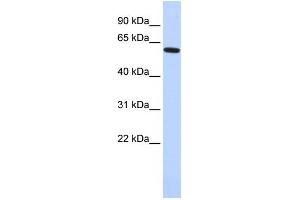 WB Suggested Anti-EYA1 Antibody Titration:  0.