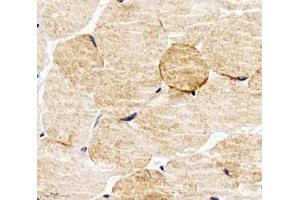 Immunohistochemistry analysis of paraffin-embedded mouse skeletal muscle using PPAPDC3 (ABIN7075036) at dilution of 1: 4000 (PPAPDC3 anticorps)