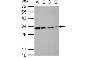 WB Image Sample (30 ug of whole cell lysate) A: 293T B: A431 C: HeLa D: HepG2 12% SDS PAGE antibody diluted at 1:10000 (DCK anticorps)
