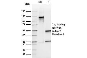 SDS-PAGE Analysis Purified S100A9 Recombinant Mouse Monoclonal Antibody (rMAC3781). (Recombinant S100A8 anticorps)