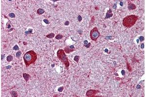 Human Brain, Cortex: Formalin-Fixed, Paraffin-Embedded (FFPE)