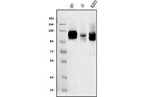 Western blot analysis of DDR2 using anti-DDR2 antibody (ABIN3043008).