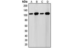 Western blot analysis of SENP7 expression in WI38 (A), HeLa (B), NIH3T3 (C), Jurkat (D) whole cell lysates. (SENP7 anticorps  (C-Term))