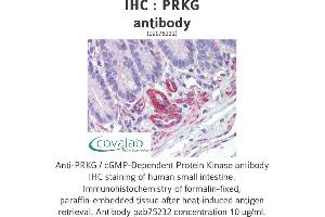 Image no. 1 for anti-PRKG antibody (ABIN1738352) (PRKG anticorps)
