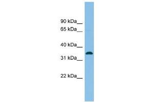 SRR antibody used at 1 ug/ml to detect target protein. (SRR anticorps  (Middle Region))