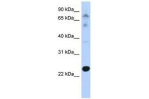 Image no. 1 for anti-Cysteine-Rich Hydrophobic Domain 2 (CHIC2) (N-Term) antibody (ABIN6743442) (CHIC2 anticorps  (N-Term))