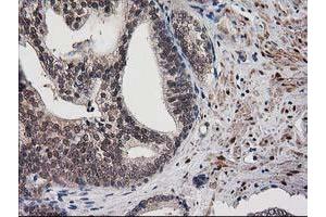 Image no. 1 for anti-Destrin (Actin Depolymerizing Factor) (DSTN) antibody (ABIN1497908)