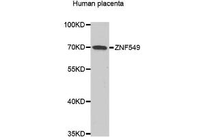 Western blot analysis of extracts of human placenta, using ZNF549 antibody.