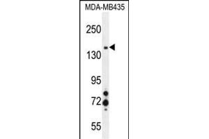 MET Antibody (ABIN1881539 and ABIN2845394) western blot analysis in MDA-M cell line lysates (35 μg/lane). (c-MET anticorps)