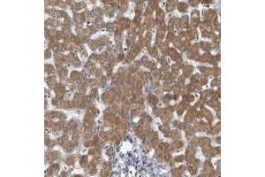 Immunohistochemical staining of human liver with LYSMD1 polyclonal antibody  shows moderate cytoplasmic positivity in hepatocytes. (LYSMD1 anticorps)