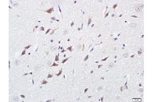 Paraformaldehyde-fixed, paraffin embedded rat brain, Antigen retrieval by boiling in sodium citrate buffer (pH6) for 15min, Block endogenous peroxidase by 3% hydrogen peroxide for 30 minutes, Blocking buffer (normal goat serum) at 37°C for 20min, Antibody incubation with GPM6B Polyclonal Antibody, Unconjugated  at 1:500 overnight at 4°C, followed by a conjugated secondary and DAB staining (GPM6B anticorps  (AA 1-100))