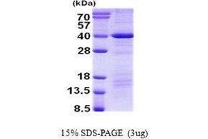 Figure annotation denotes ug of protein loaded and % gel used. (DEDD Protéine)